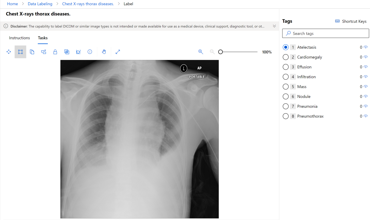 X-ray DICOM image to be labeled.