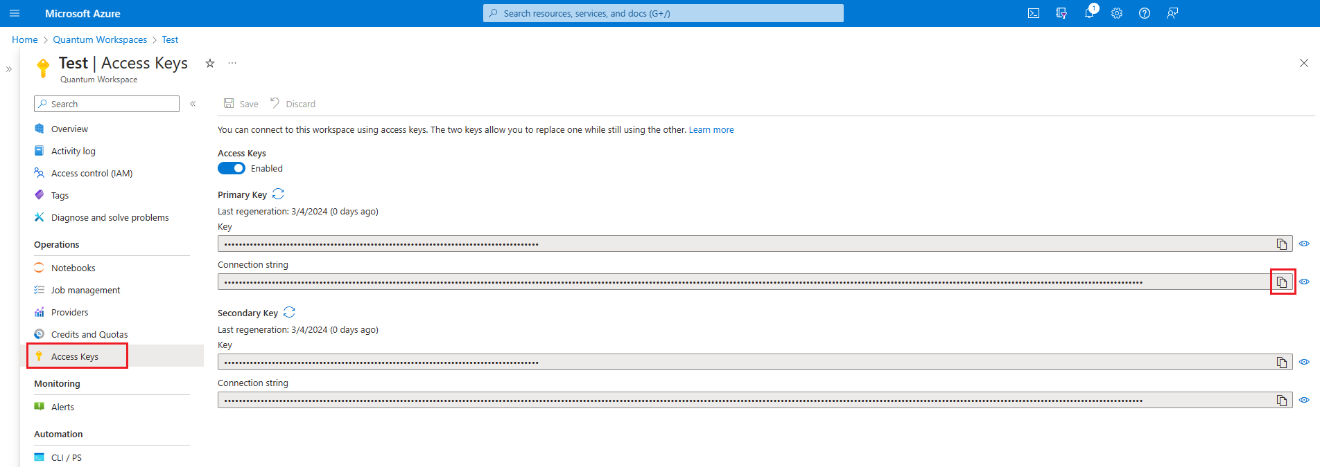 Screenshot of Azure portal showing how to copy the connection strings.