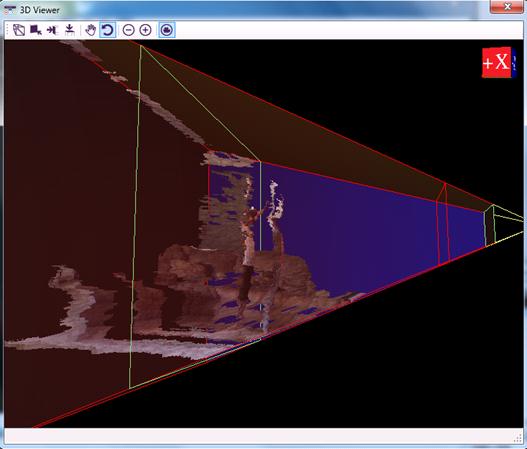 3D Viewer showing a side view of the image in Figure 5