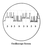Screen