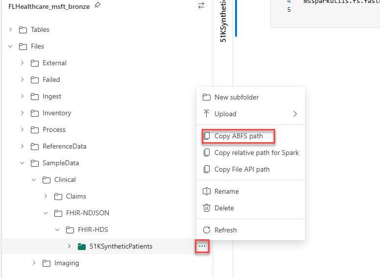 Screenshot of selecting Copy ABFS path of 51KSyntheticPatients.