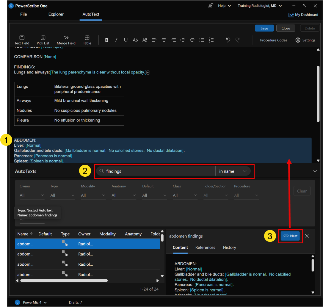 Screenshot of the PowerScribe One AutoText Editor showing how to nest AutoText.