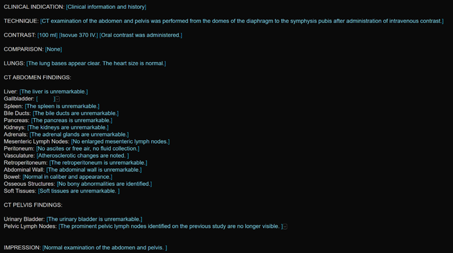 Screenshot that shows a PowerScribe One report with structured AutoText content including Clinical Indication, Technique, Contrast, Findings, and Impression sections.