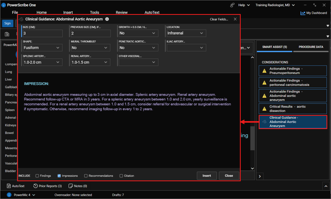 Screenshot of the Clinical Guidance dialog for abdominal aortic aneurysm showing guideline fields, generated impression text, and the related Smart Assist consideration in the Report Editor.