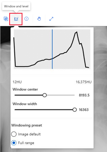 Captura de pantalla que muestra la herramienta Ventana y nivel para imágenes DICOM.