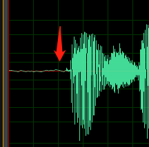 DC offset or echo