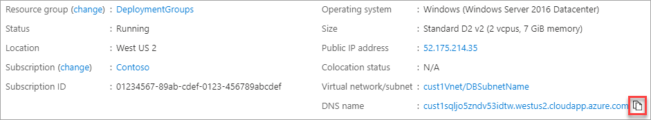 Azure への SQL DNS の配置。